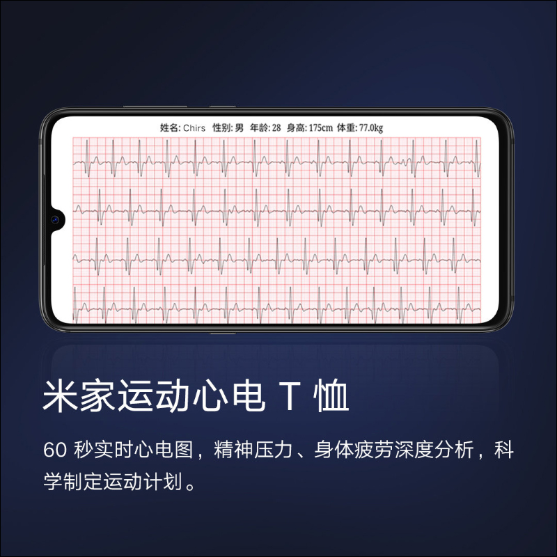 小米眾籌推出米家運動心電T恤,1分鐘可精準測量即時心電,隨時掌握運動狀態 - 電腦王阿達 小米眾籌推出米家運動心電T恤,1分鐘可精準測量即時心電,隨時掌握運動狀態 - 電腦王阿達