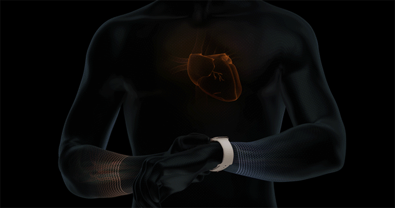 Apple Watch 才在台灣開放 ECG 心電圖功能，就有醫師分享幫病患找出心臟問題的實例 - 電腦王阿達