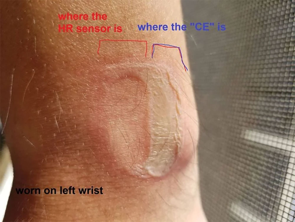 Fitbit 遭提起集體訴訟,旗下多款智慧手錶都有使人燙傷的風險 - 電腦王阿達 Fitbit 遭提起集體訴訟,旗下多款智慧手錶都有使人燙傷的風險 - 電腦王阿達