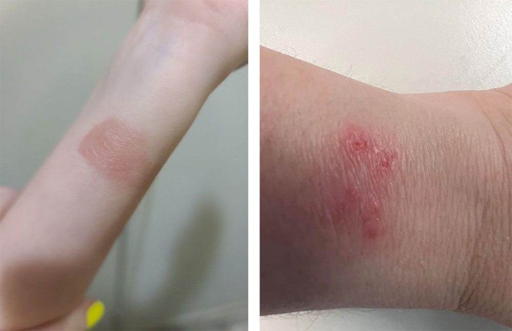Fitbit 遭提起集體訴訟,旗下多款智慧手錶都有使人燙傷的風險 - 電腦王阿達 Fitbit 遭提起集體訴訟,旗下多款智慧手錶都有使人燙傷的風險 - 電腦王阿達