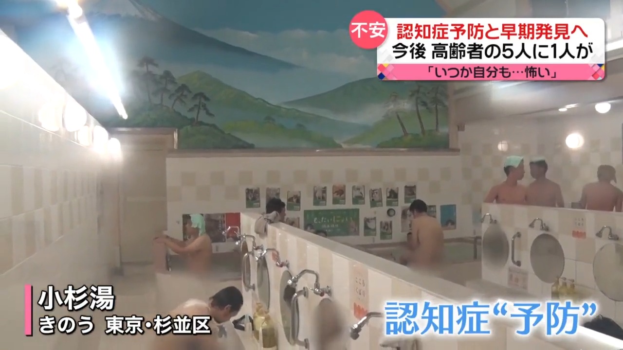 日本推出γ波和腦檢查服務,期望能夠預防或檢測失智症 - 電腦王阿達 日本推出γ波和腦檢查服務,期望能夠預防或檢測失智症 - 電腦王阿達