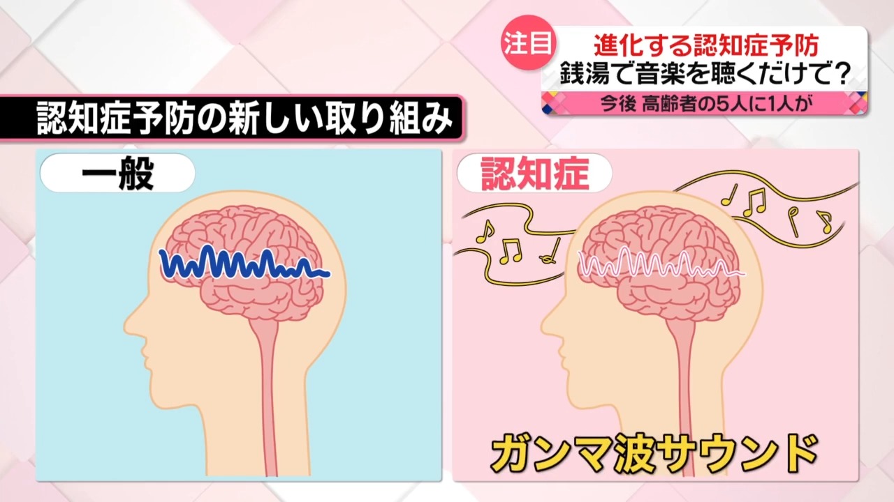 日本推出γ波和腦檢查服務,期望能夠預防或檢測失智症 - 電腦王阿達 日本推出γ波和腦檢查服務,期望能夠預防或檢測失智症 - 電腦王阿達