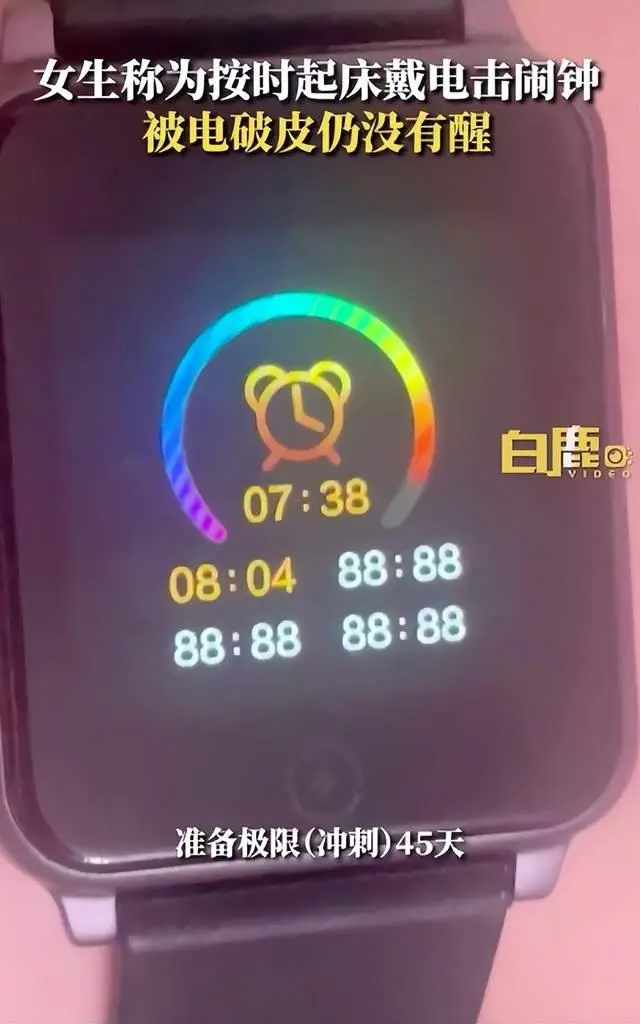 中國女大生為了早起使用電擊手錶並設置最高 480V 電壓,結果睡死導致腳踝燒傷破皮 - 電腦王阿達 中國女大生為了早起使用電擊手錶並設置最高 480V 電壓,結果睡死導致腳踝燒傷破皮 - 電腦王阿達