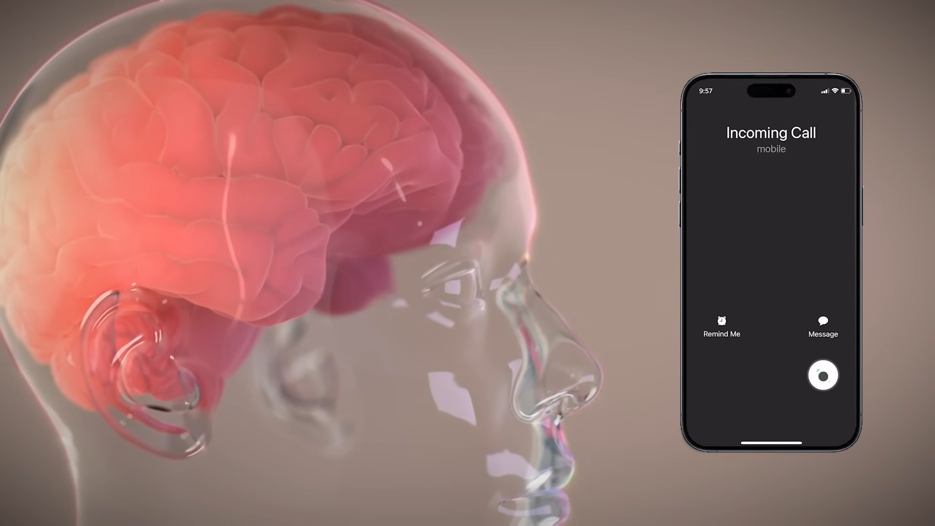 馬斯克宣布 Neuralink 完成首位晶片植入人腦的人體實驗 - 電腦王阿達 馬斯克宣布 Neuralink 完成首位晶片植入人腦的人體實驗 - 電腦王阿達