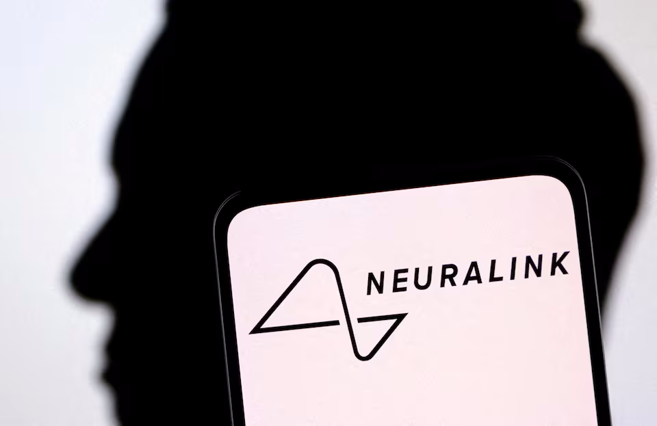 影片展示腦部植入 Neuralink 晶片患者，現在可以用大腦來玩《文明帝國VI》和下西洋棋 - 電腦王阿達