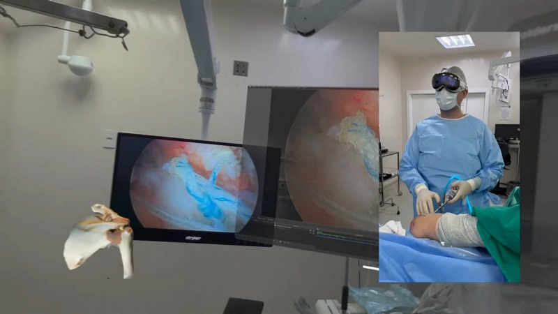 Apple Vision Pro 再度登上手術檯！巴西醫生用它進行肩關節鏡手術 - 電腦王阿達