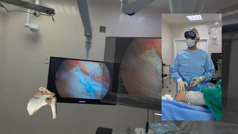 Apple Vision Pro 再度登上手術檯!巴西醫生用它進行肩關節鏡手術 - 電腦王阿達 Apple Vision Pro 再度登上手術檯!巴西醫生用它進行肩關節鏡手術 - 電腦王阿達