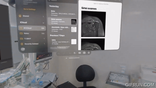 Apple Vision Pro 再度登上手術檯!巴西醫生用它進行肩關節鏡手術 - 電腦王阿達 Apple Vision Pro 再度登上手術檯!巴西醫生用它進行肩關節鏡手術 - 電腦王阿達