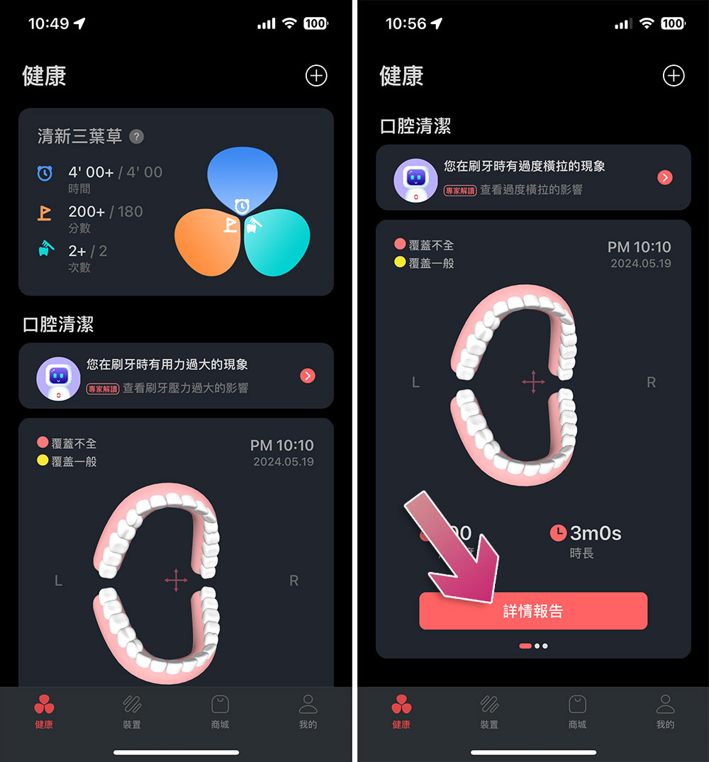 Oclean X Ultra WiFi 智慧電動牙刷開箱實測:骨傳導 AI 語音指導正確潔牙力度與區域,全齒清潔不漏刷 - 電腦王阿達 Oclean X Ultra WiFi 智慧電動牙刷開箱實測:骨傳導 AI 語音指導正確潔牙力度與區域,全齒清潔不漏刷 - 電腦王阿達