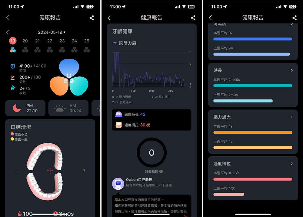 Oclean X Ultra WiFi 智慧電動牙刷開箱實測:骨傳導 AI 語音指導正確潔牙力度與區域,全齒清潔不漏刷 - 電腦王阿達 Oclean X Ultra WiFi 智慧電動牙刷開箱實測:骨傳導 AI 語音指導正確潔牙力度與區域,全齒清潔不漏刷 - 電腦王阿達