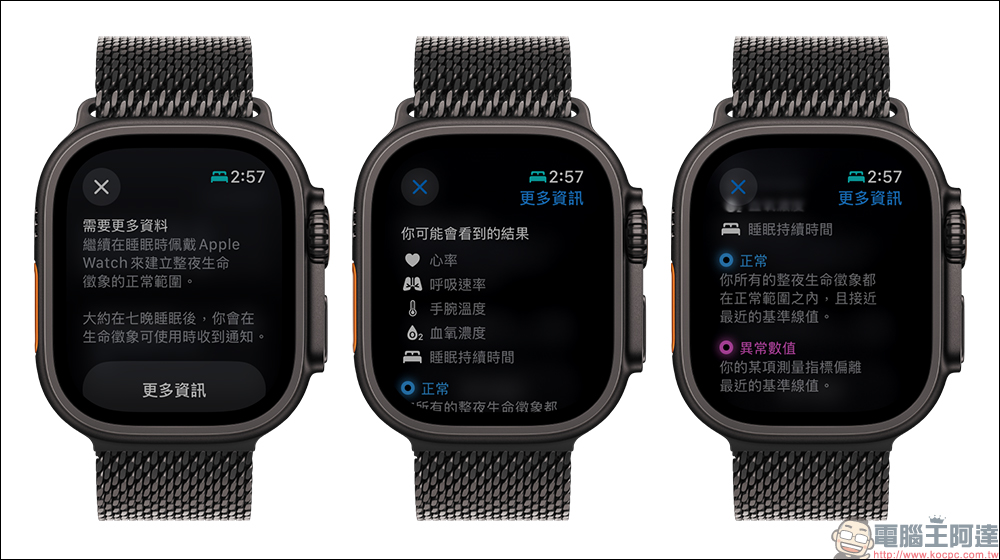 多名 Apple Watch 用戶表示「生命徵象」應用幫助自己提前檢測到疾病(同場加映:watch OS 11.1 預計加入睡眠呼吸中止症通知功能) - 電腦王阿達 多名 Apple Watch 用戶表示「生命徵象」應用幫助自己提前檢測到疾病(同場加映:watch OS 11.1 預計加入睡眠呼吸中止症通知功能) - 電腦王阿達